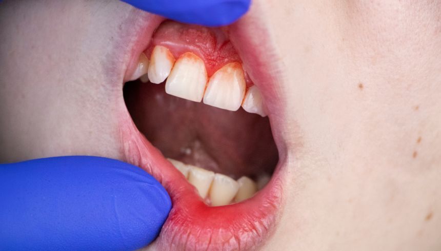 Eerste hulp bij bloed uit de mond · Gezondheid en wetenschap